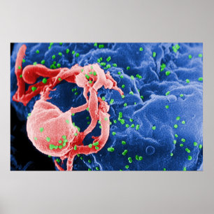 Pôster Micrografia de elétron do linfócito HIV-1 de