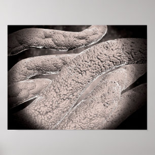 Poster Microscopic View Of Corncob Formation