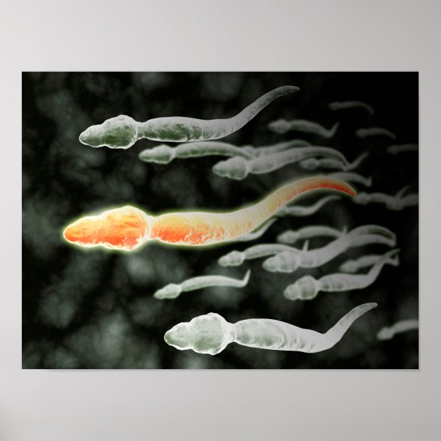 Poster Microscopic View Of Sperm Traveling (Frente)