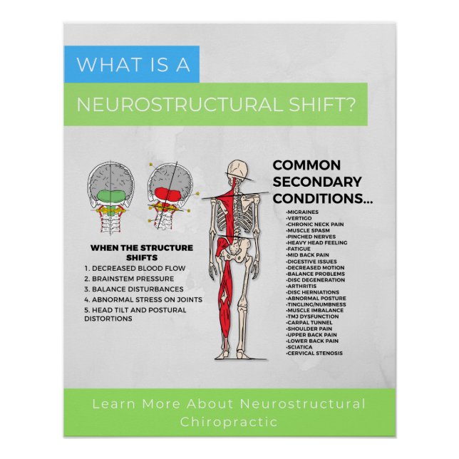 Pôster O que é? (Frente)
