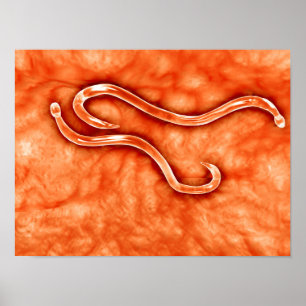 Pôster Opinião microscópica o Hookworm 2