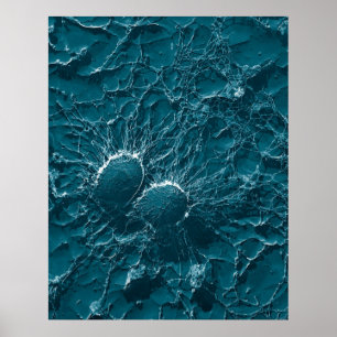 Pôster Pilhas bacterianas do staphylococcus - fim áureo