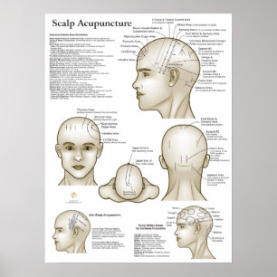 Poster Pontos de Acupuntura da Cabeça no Couro Cabeludo