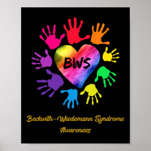 Poster Porque com a Síndrome de Wiedemann a consciência é