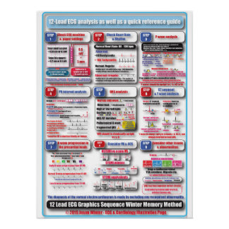Pôster POSTER de treinamento ECG