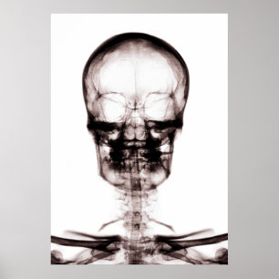 PÔSTER POSTER/IMPRESSÃO X RAY VISION SKELETON SKULL ORIG/