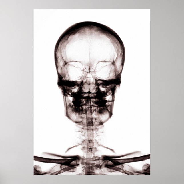 PÔSTER POSTER/IMPRESSÃO X RAY VISION SKELETON SKULL ORIG/ (Frente)