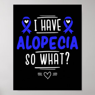 Poster Presente para Doentes com Calvície Spot Perda de C