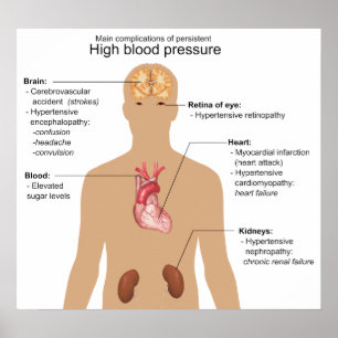 Poster Principais Complicações do Gráfico de Pressão Arte