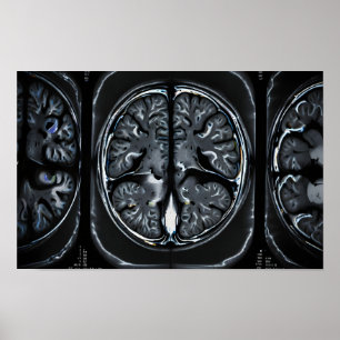 Poster ressonância magnética cerebral