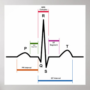 Poster Ritmo sinusal num diagrama ECG eletrocardiograma