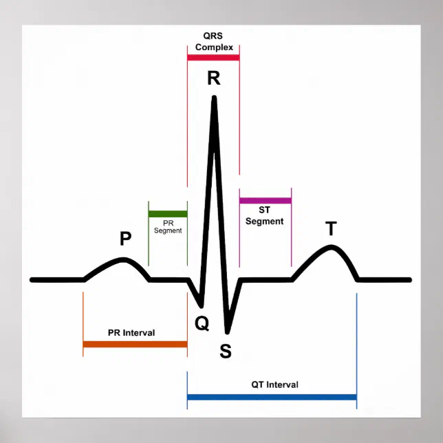 Poster Ritmo sinusal num diagrama ECG eletrocardiograma | Zazzle Brasil
