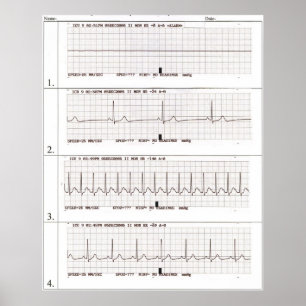 Pôster ritmos do ekg