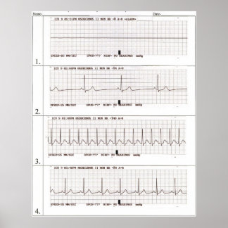 Pôster ritmos ekg