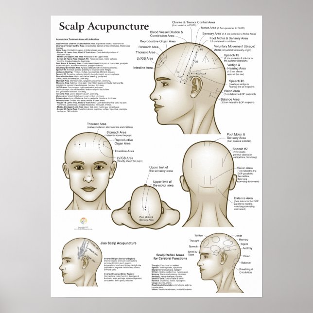 Poster Scalp Head Acupuncture Points (Frente)