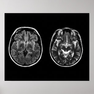 Poster Scanner mri do cérebro
