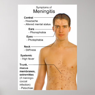 Pôster Sintomas Gráfico de Inflamação Doença Meningite