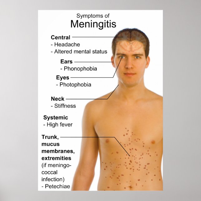 Pôster Sintomas Gráfico de Inflamação Doença Meningite (Frente)