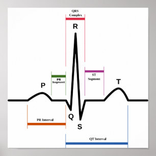 Poster Sinus Ritmo Eletrocardiograma Diagrama ECG