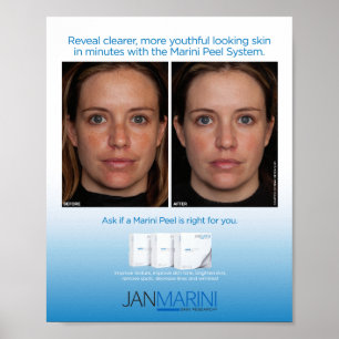 Pôster Sistema 8x10 da casca de Marini "