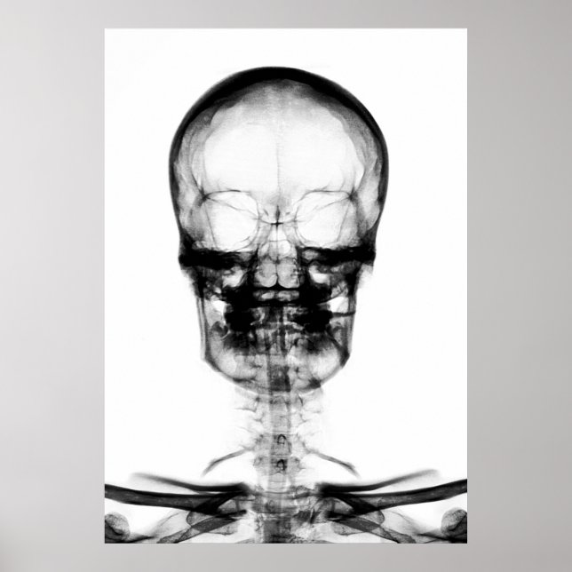 Pôster SKELETON DE VISÃO poster/IMPRESSÃO X RAY - B&W (Frente)