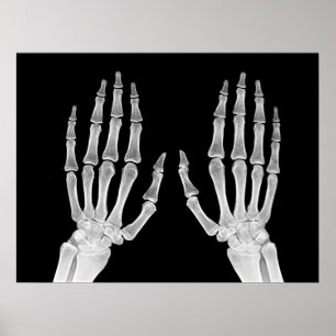 Poster Skeleton Hands Xray Imagem da Anatomia Humana
