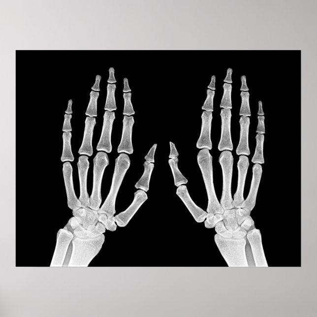 Poster Skeleton Hands Xray Imagem da Anatomia Humana (Frente)