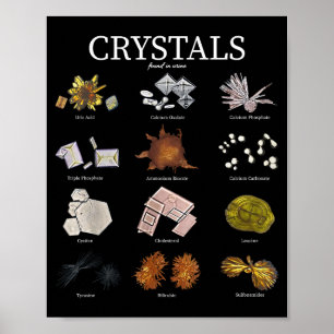 Poster Técnico de Laboratório de Cristal de Urina de Labo