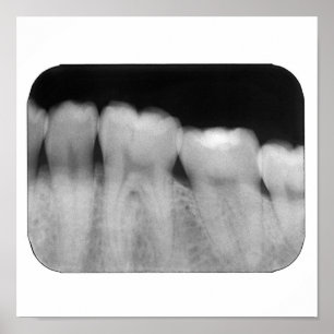 Poster Teeth with filling
