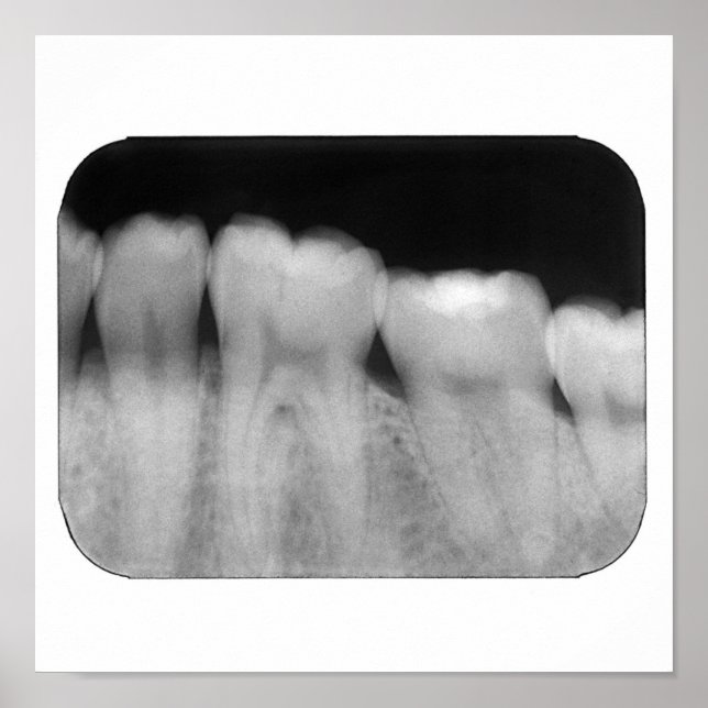 Poster Teeth with filling (Frente)