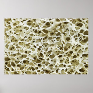 Poster Textura porosa ampliada do osso anca humano