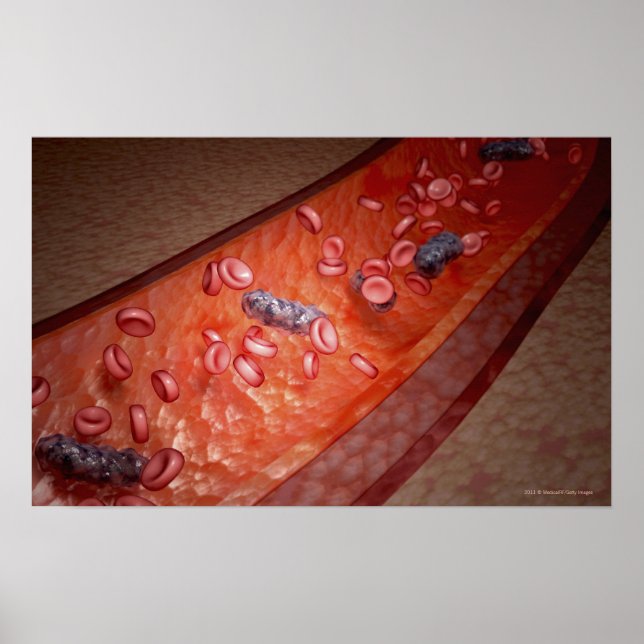 Poster Transformação microscópica de uma infecção sanguín (Frente)