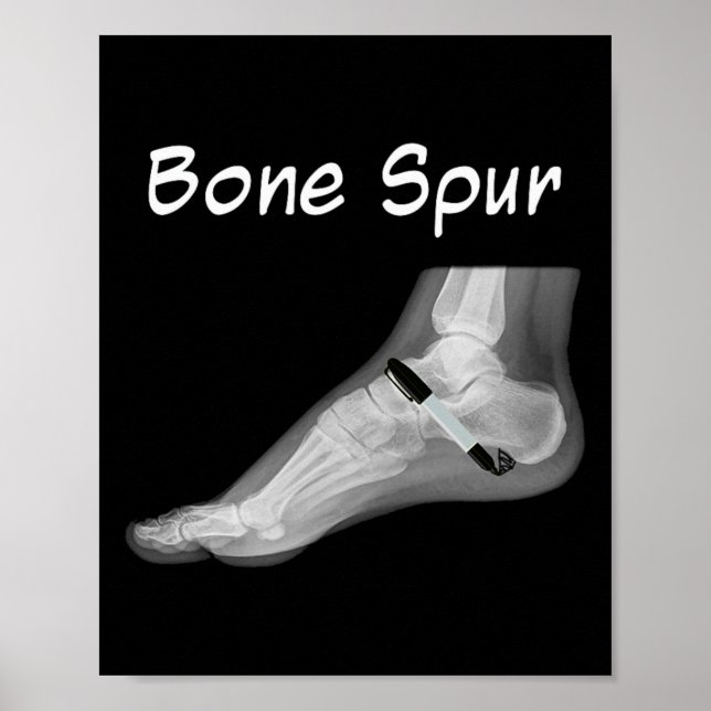 Poster Trump Bone Spur Ink Pen Funny Anti Trump  (Frente)