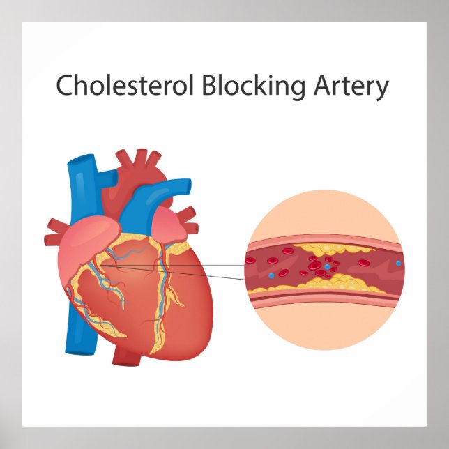 Poster Vasos sanguíneos estreitos (Frente)