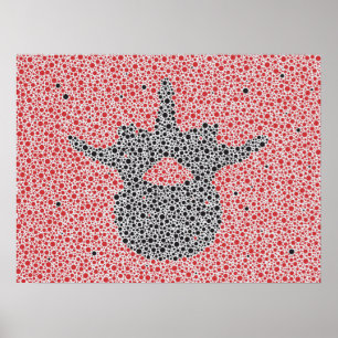 Poster Vertebrae lombar Trabalho de arte da Anatomia quir