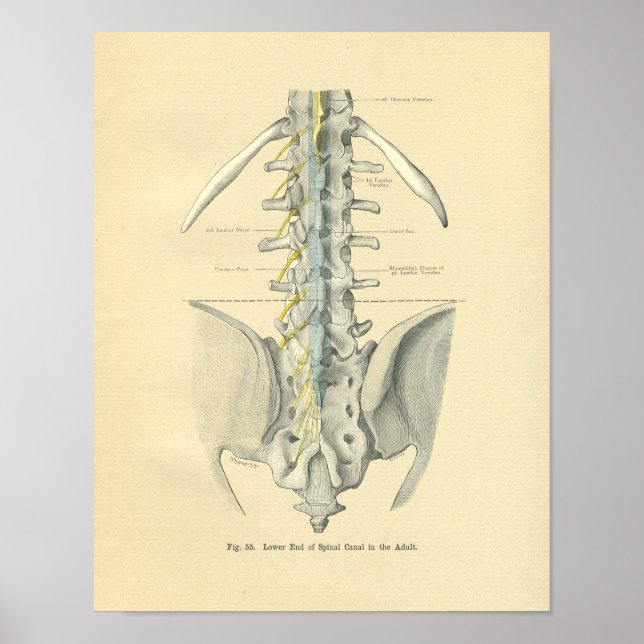 Poster Vintage Frohse Anatômica Lumbar Spine (Frente)