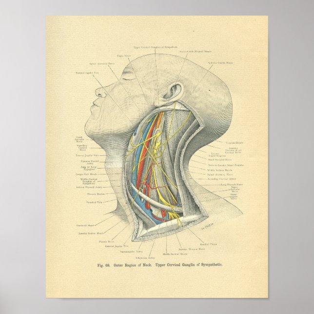 Poster Vintage Frohse Anatomical Lateral Necrose (Frente)