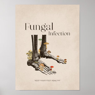 Poster Vintage Infecção Fúngica Pé