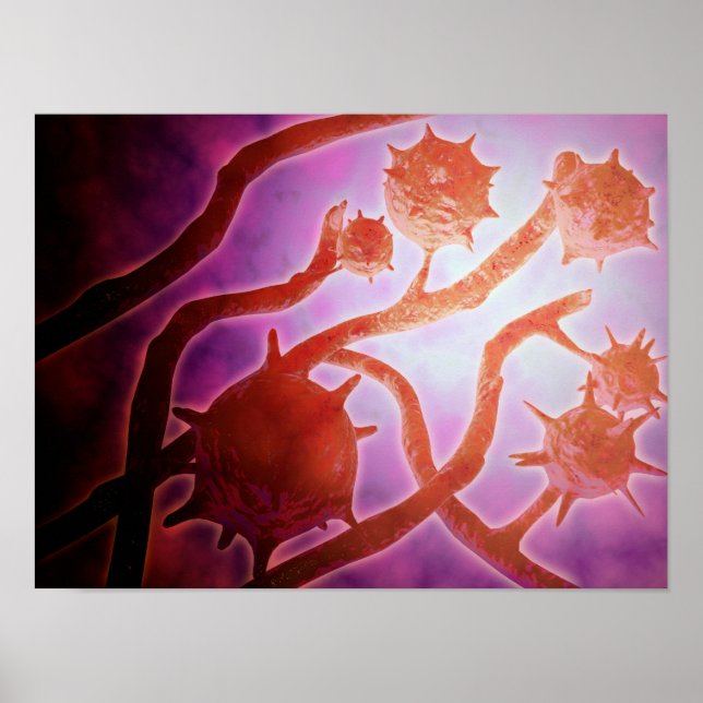 Pôster Visão Microscópica Da Histoplasmose (Frente)