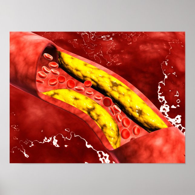 Pôster Visão Microscópica De Dentro De Gesso Gordo Na Art (Frente)