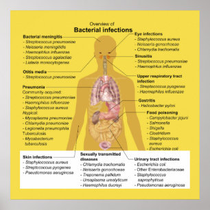 Pôster Vista geral de infecções bacterianas