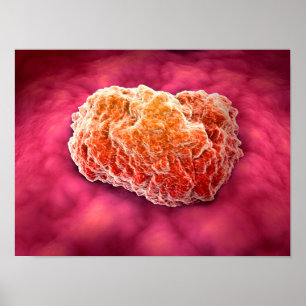 Poster Vista microscópica do tumor 3