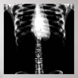PÔSTER X RAY SKELETON TORSO RIBS - B&W