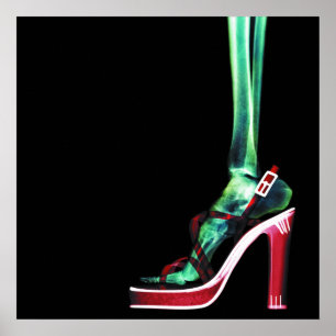 POSTER XRAY HEEL LADY SKELETON FOOT ORIGINAL
