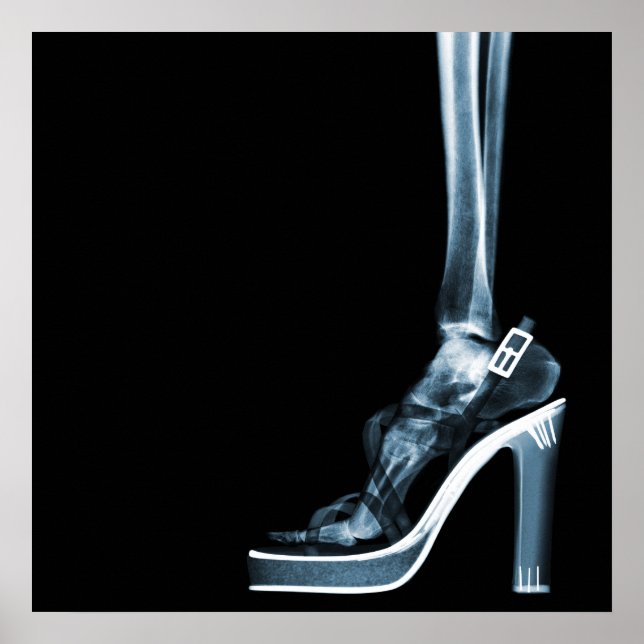 POSTER XRAY HIGH HEEL LADY SKELETON FOOT  BLUE (Frente)