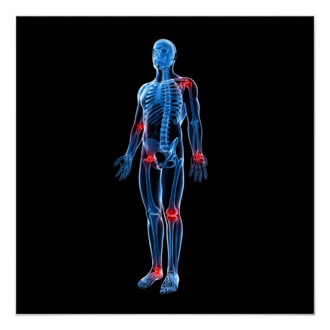 Pôster Xray humano (Frente)
