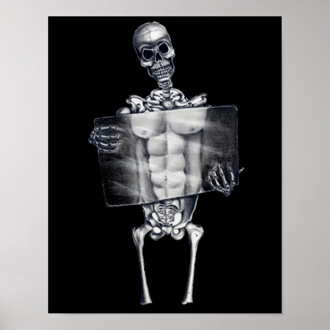 Posters Skeleton Chest Xray (Frente)