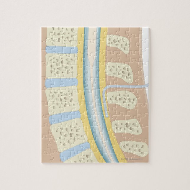 Quebra-cabeça Anestesia Epidural (Vertical)