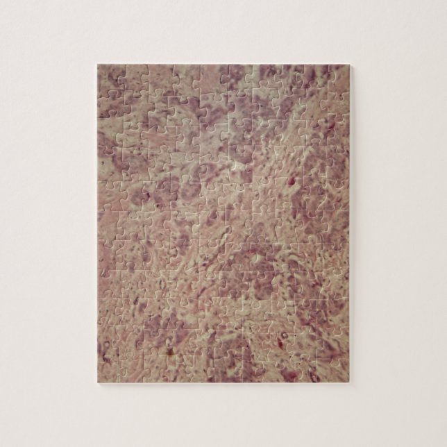 Quebra-cabeça Cancro da mama sob o microscópio (Vertical)