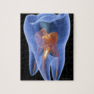Quebra-cabeça Dente, secção transversal transparente de um mol